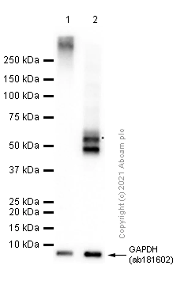 Western blot - Anti-GLP-1R antibody [EPR21819] (AB218532)