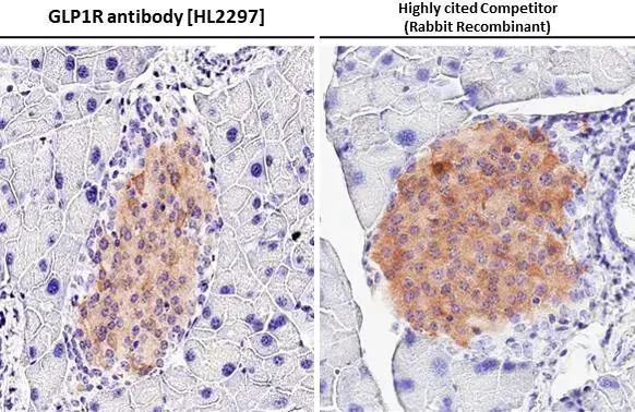 Immunohistochemistry (Formalin/PFA-fixed paraffin-embedded sections) - Anti-GLP1R antibody [HL2297] - BSA and Azide free (AB325859)