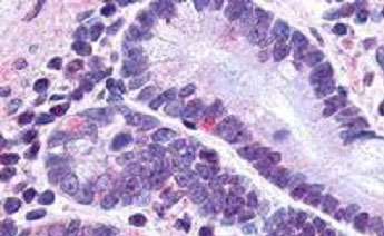 Immunohistochemistry (Formalin/PFA-fixed paraffin-embedded sections) - Anti-GLP2R antibody - N-terminal (AB188595), expandable thumbnail