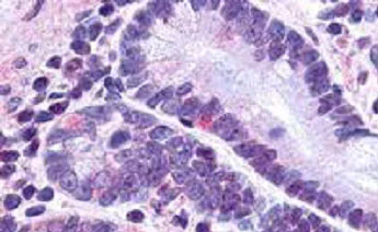 Immunohistochemistry (Formalin/PFA-fixed paraffin-embedded sections) - Anti-GLP2R antibody - N-terminal (AB188595)