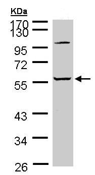 Western blot - Anti-GLRA2 antibody (AB97628), expandable thumbnail