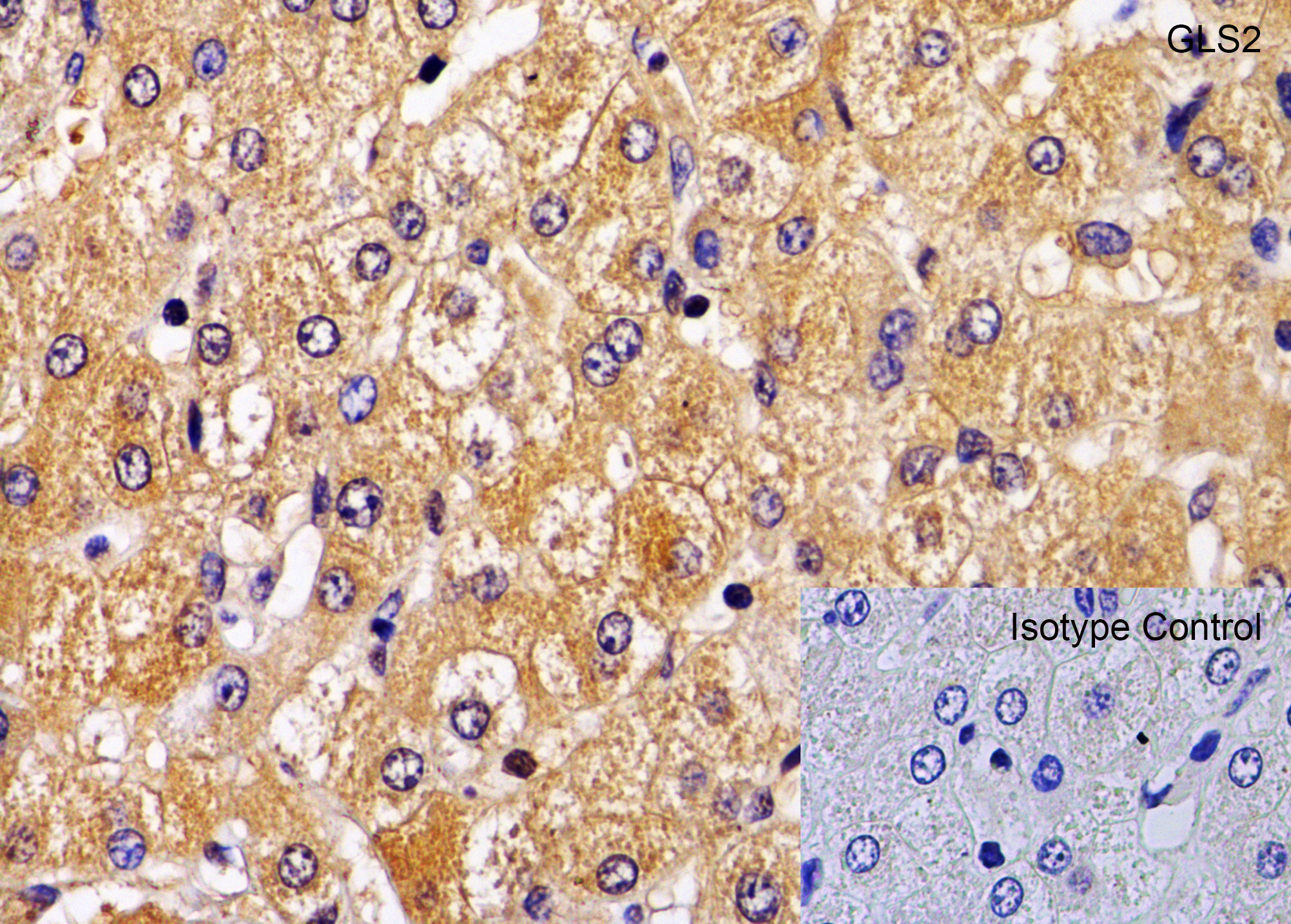 Immunohistochemistry (Formalin/PFA-fixed paraffin-embedded sections) - Anti-GLS2 antibody (AB113509), expandable thumbnail