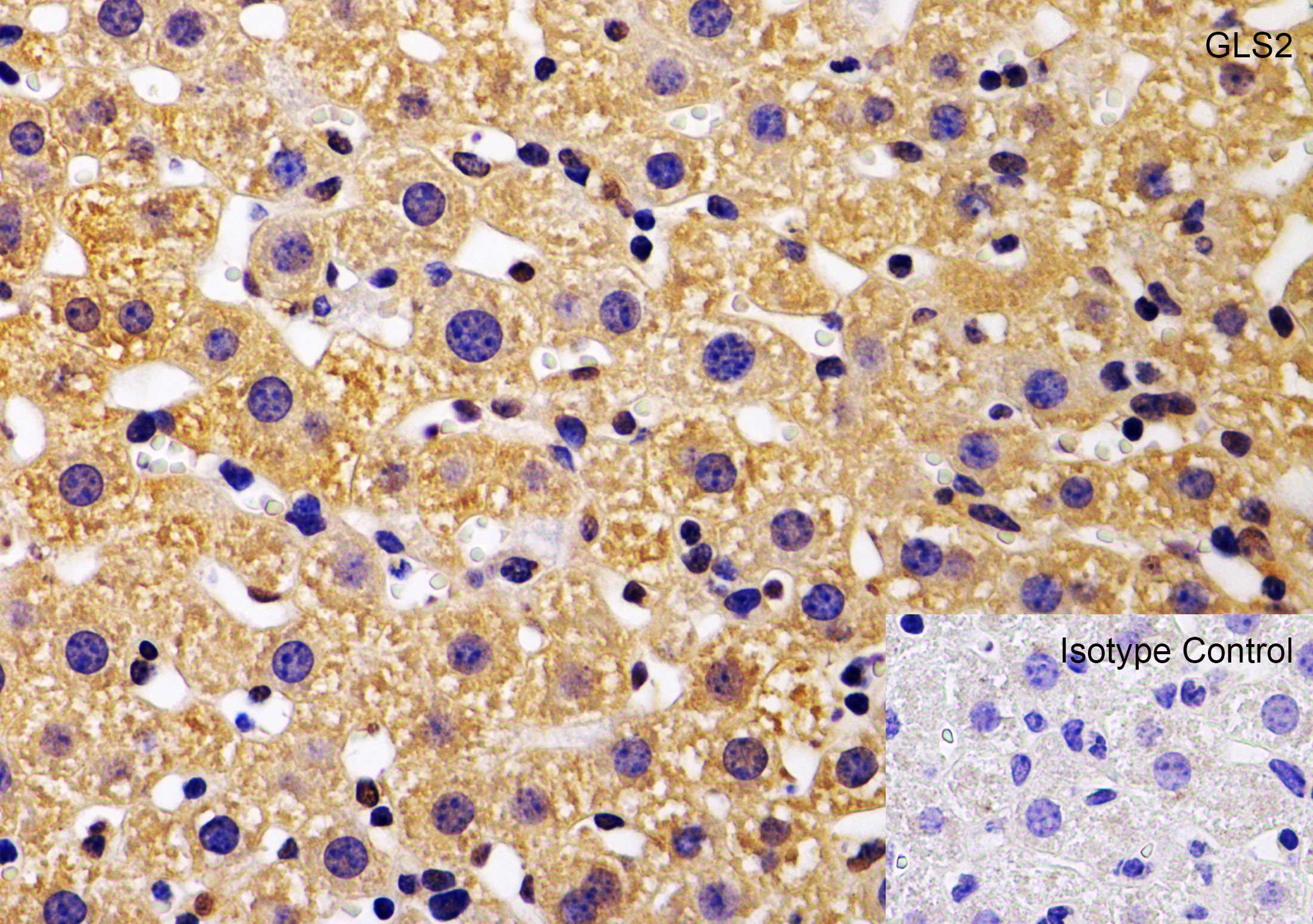 Immunohistochemistry (Formalin/PFA-fixed paraffin-embedded sections) - Anti-GLS2 antibody (ab113509), expandable thumbnail