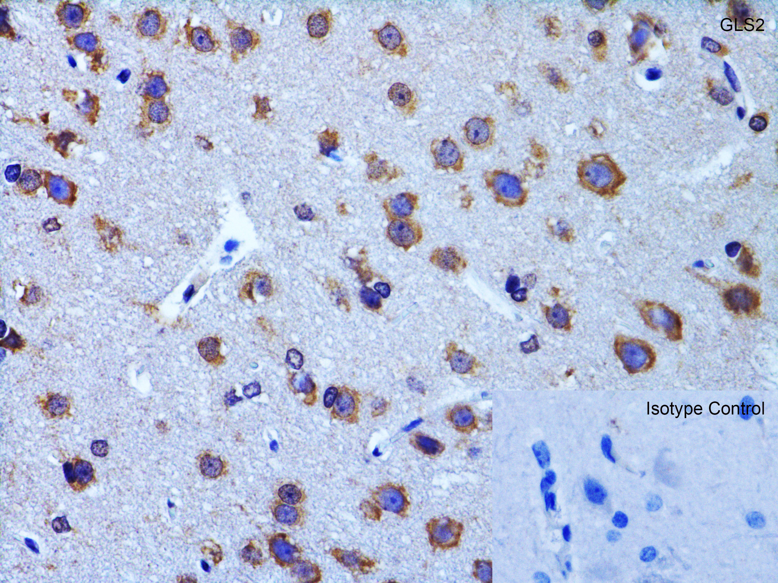 Immunohistochemistry (Formalin/PFA-fixed paraffin-embedded sections) - Anti-GLS2 antibody (AB113509), expandable thumbnail