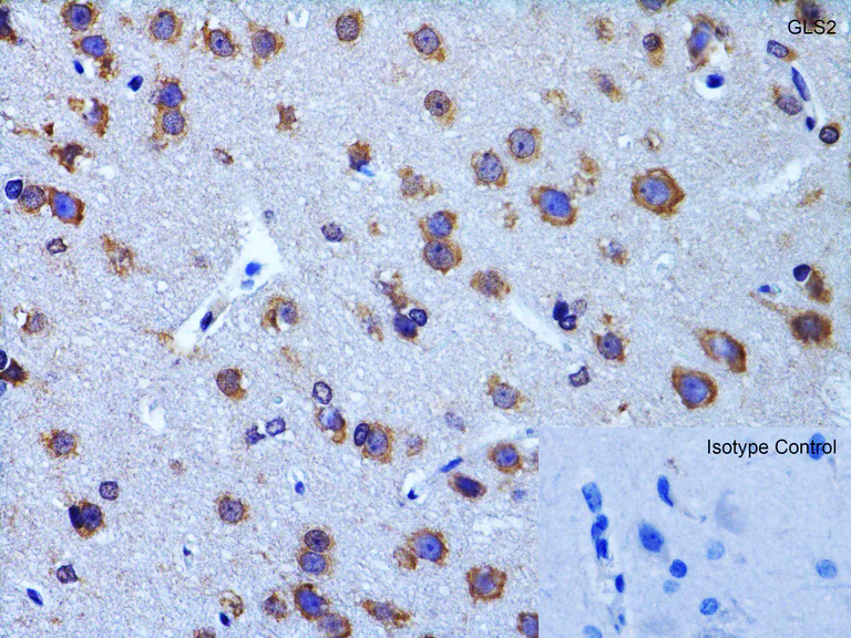 Immunohistochemistry (Formalin/PFA-fixed paraffin-embedded sections) - Anti-GLS2 antibody (AB113509)