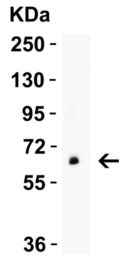 Western blot - Anti-GLS2 antibody (ab113509), expandable thumbnail