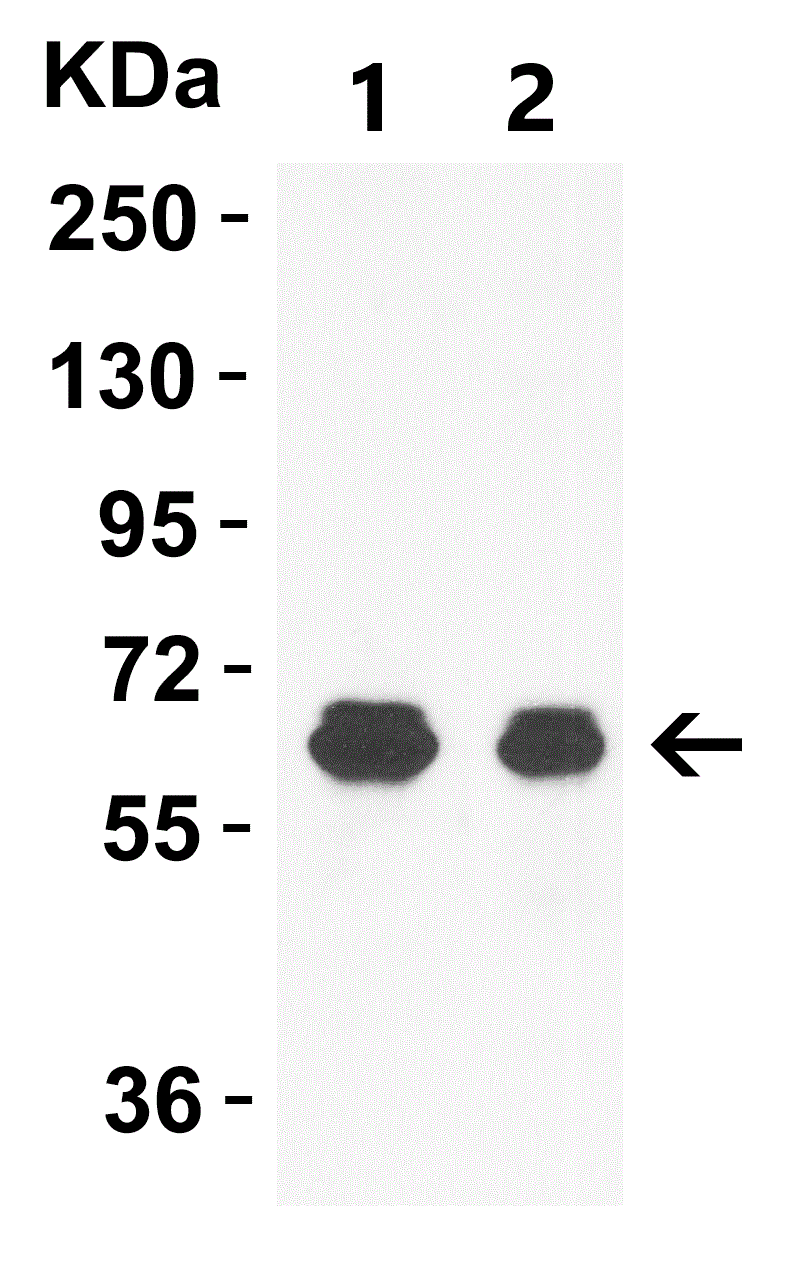 Western blot - Anti-GLS2 antibody (ab113509), expandable thumbnail