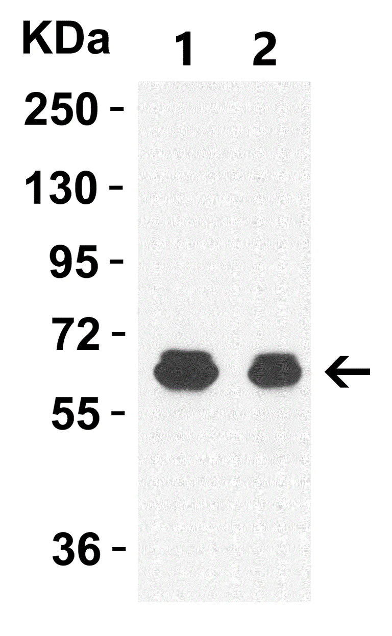 Western blot - Anti-GLS2 antibody (AB113509)