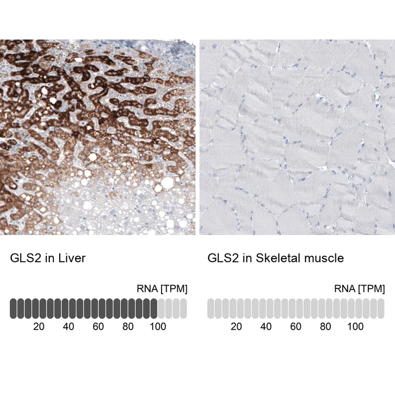 Immunohistochemistry (Formalin/PFA-fixed paraffin-embedded sections) - Anti-GLS2 Antibody [CL7721] (AB327124)
