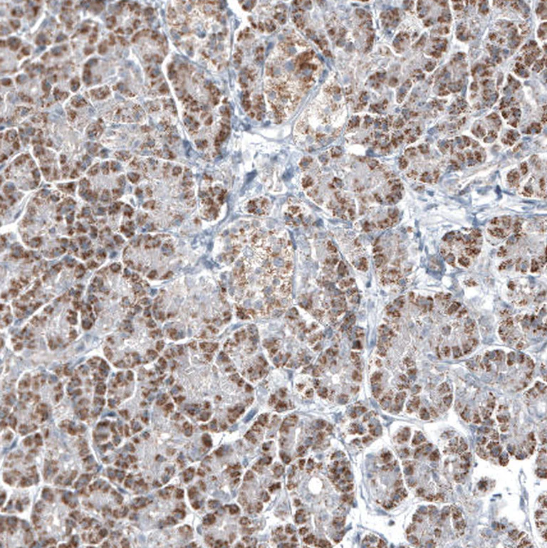 Immunohistochemistry (Formalin/PFA-fixed paraffin-embedded sections) - Anti-GLS2 Antibody [CL7721] (AB327124)