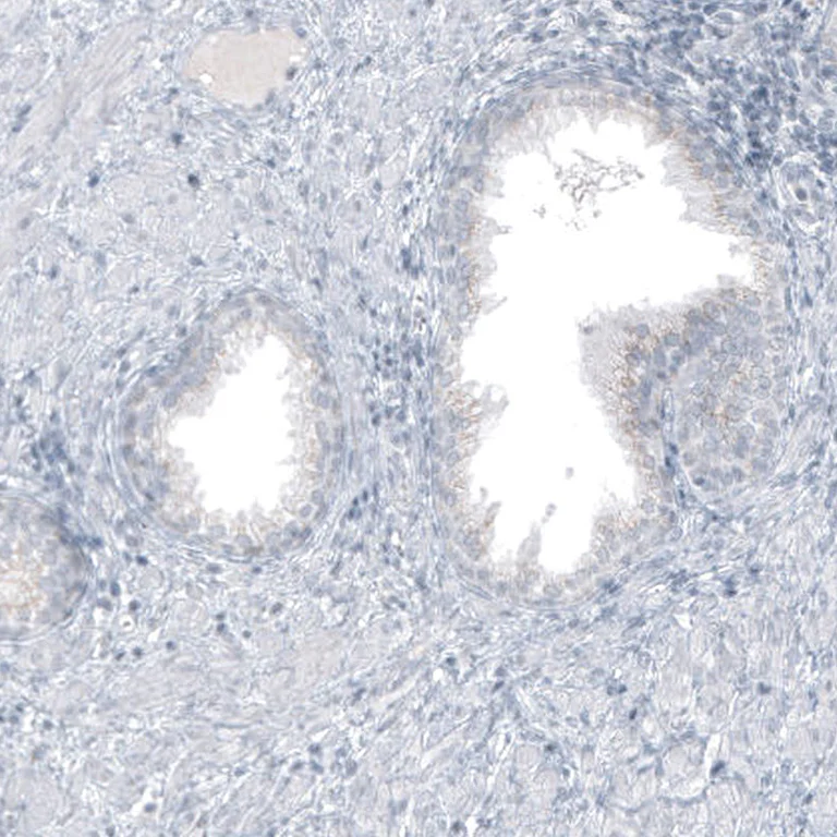 Immunohistochemistry (Formalin/PFA-fixed paraffin-embedded sections) - Anti-GLS2 Antibody [CL7721] (AB327124)