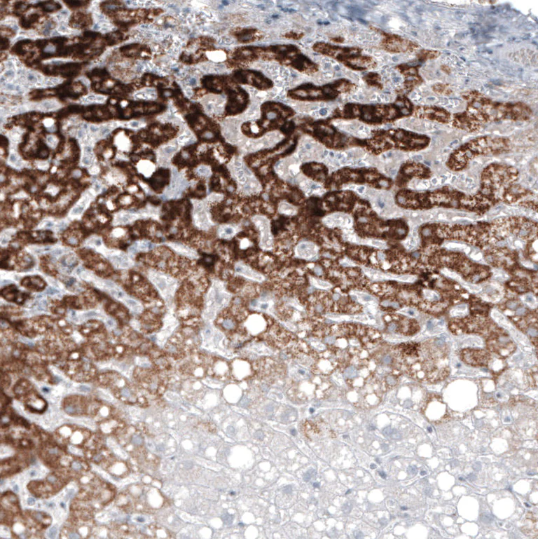Immunohistochemistry (Formalin/PFA-fixed paraffin-embedded sections) - Anti-GLS2 Antibody [CL7721] (AB327124)