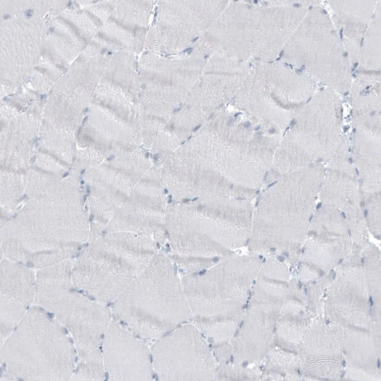 Immunohistochemistry (Formalin/PFA-fixed paraffin-embedded sections) - Anti-GLS2 Antibody [CL7721] (AB327124)