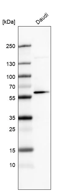 Western blot - Anti-GLS2 Antibody [CL7721] (AB327124)