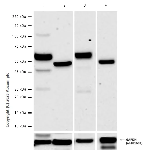 Western blot - Anti-GLS2 antibody [EPR27332-67] (AB308304)