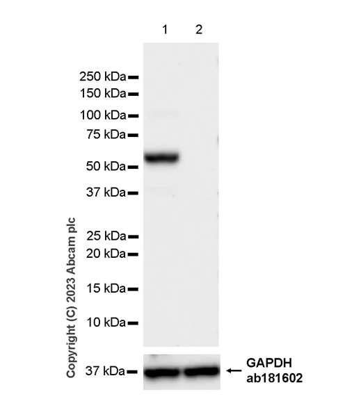 Western blot - Anti-GLS2 antibody [EPR27332-67] - BSA and Azide free (AB308305)