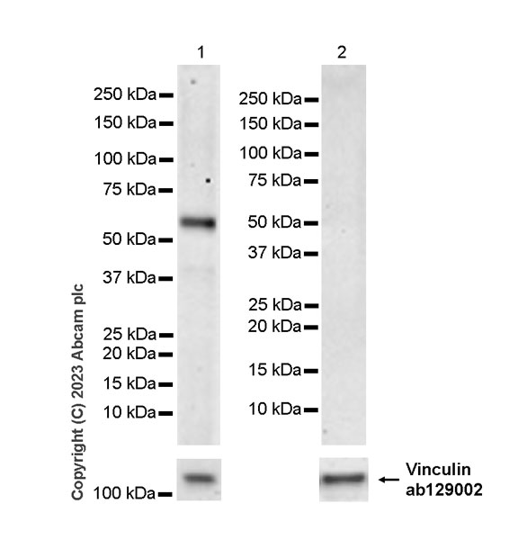 Western blot - Anti-GLS2 antibody [EPR27332-67] - BSA and Azide free (AB308305), expandable thumbnail