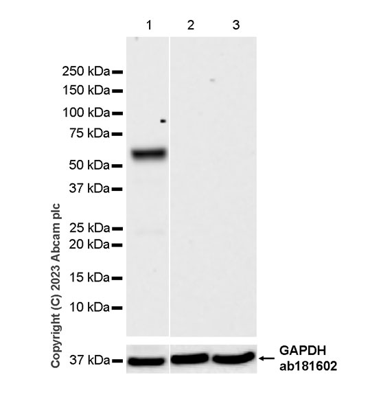 Western blot - Anti-GLS2 antibody [EPR27332-67] - BSA and Azide free (AB308305), expandable thumbnail