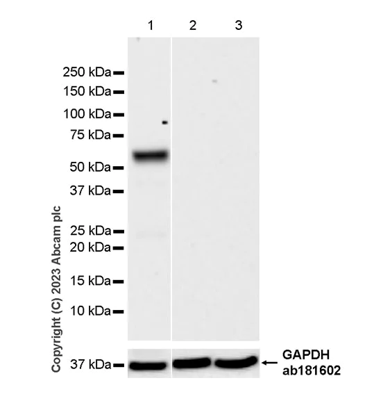Western blot - Anti-GLS2 antibody [EPR27332-67] - BSA and Azide free (AB308305)