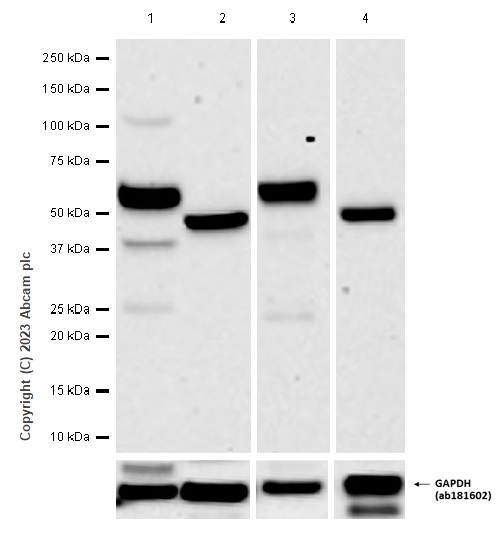 Western blot - Anti-GLS2 antibody [EPR27332-67] - BSA and Azide free (AB308305), expandable thumbnail