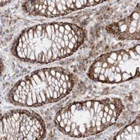 Immunohistochemistry (Formalin/PFA-fixed paraffin-embedded sections) - Anti-GLT25D2 antibody (AB122193)