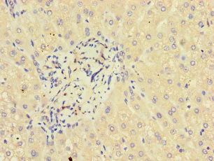 Immunohistochemistry (Formalin/PFA-fixed paraffin-embedded sections) - Anti-GLT8D1 antibody (AB236974)