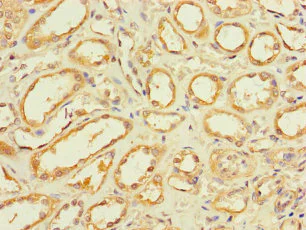 Immunohistochemistry (Formalin/PFA-fixed paraffin-embedded sections) - Anti-GLT8D1 antibody (AB236974)