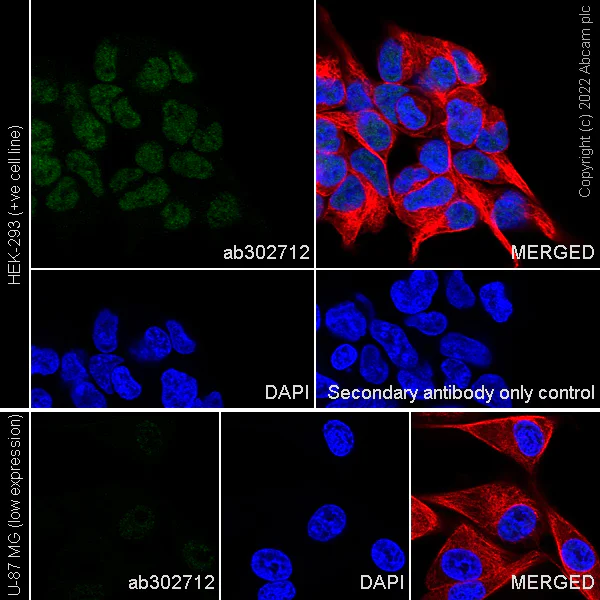 Immunocytochemistry/ Immunofluorescence - Anti-GLTSCR1 antibody [EPR26561-76] (AB302712)
