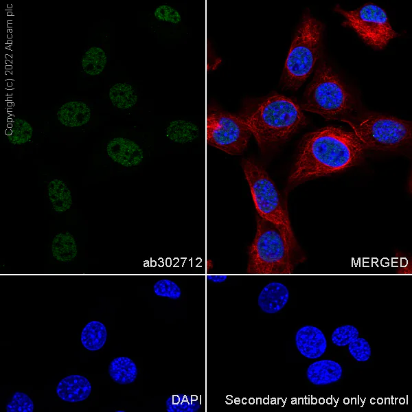 Immunocytochemistry/ Immunofluorescence - Anti-GLTSCR1 antibody [EPR26561-76] (AB302712)