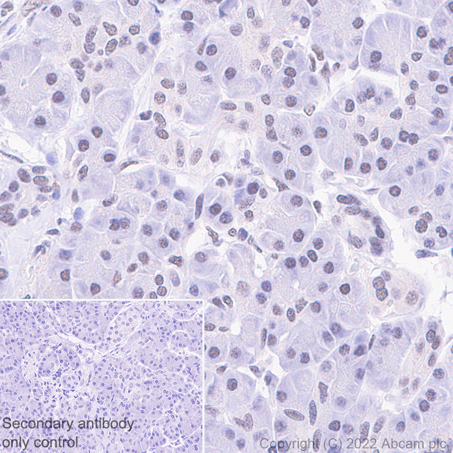 Immunohistochemistry (Formalin/PFA-fixed paraffin-embedded sections) - Anti-GLTSCR1 antibody [EPR26561-76] (AB302712)