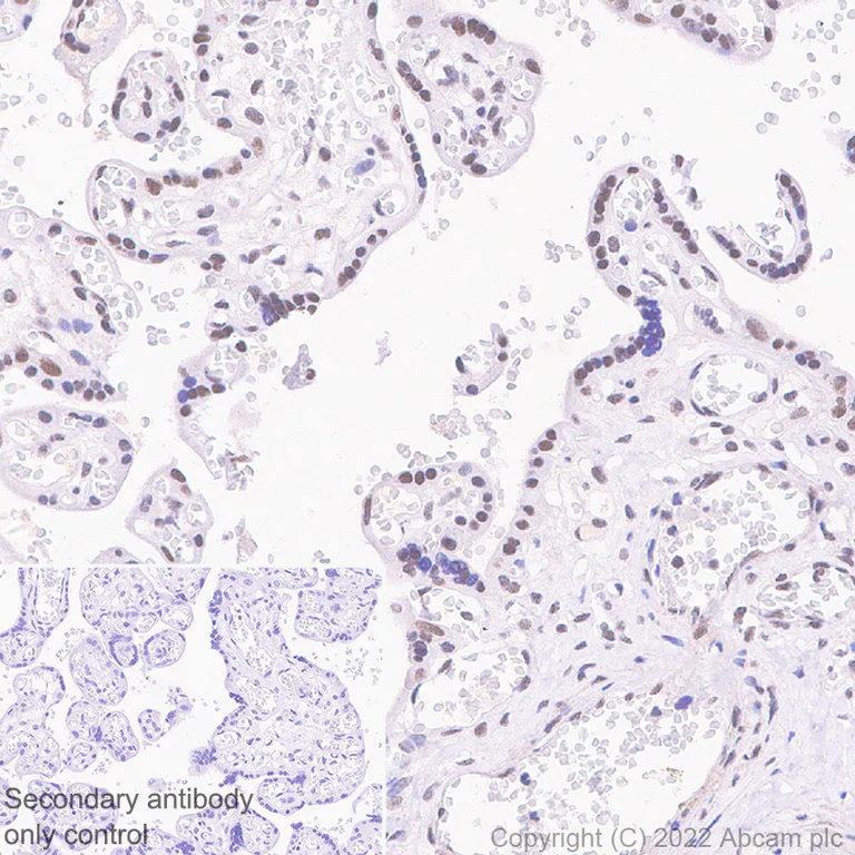 Immunohistochemistry (Formalin/PFA-fixed paraffin-embedded sections) - Anti-GLTSCR1 antibody [EPR26561-76] (AB302712)