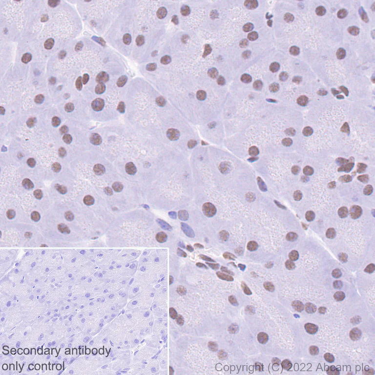 Immunohistochemistry (Formalin/PFA-fixed paraffin-embedded sections) - Anti-GLTSCR1 antibody [EPR26561-76] (AB302712)