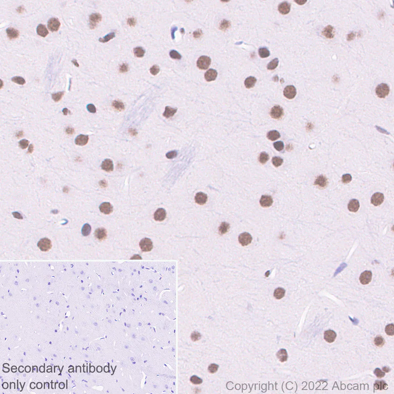 Immunohistochemistry (Formalin/PFA-fixed paraffin-embedded sections) - Anti-GLTSCR1 antibody [EPR26561-76] (AB302712)