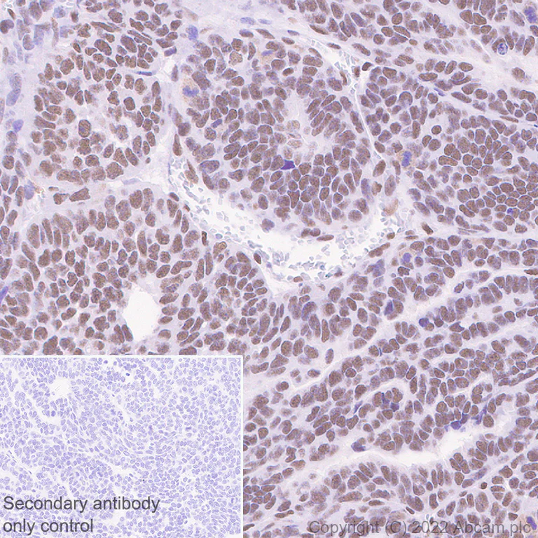 Immunohistochemistry (Formalin/PFA-fixed paraffin-embedded sections) - Anti-GLTSCR1 antibody [EPR26561-76] (AB302712)