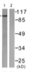 Western blot - Anti-GluA4 (phospho S862) antibody (AB61054)