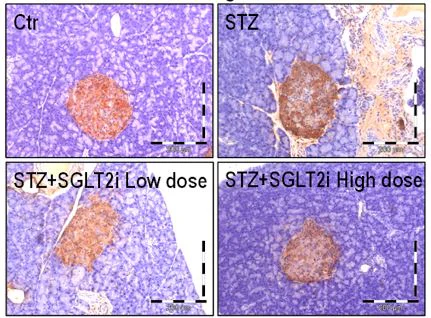 Immunohistochemistry (Formalin/PFA-fixed paraffin-embedded sections) - Anti-Glucagon antibody [EP3070] (AB92517)