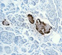 Immunohistochemistry (Formalin/PFA-fixed paraffin-embedded sections) - Anti-Glucagon antibody [EPR3070-45] (AB108426), expandable thumbnail
