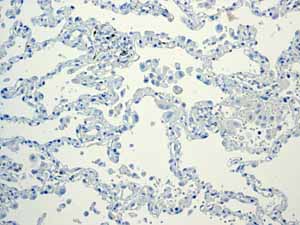 Immunohistochemistry (Formalin/PFA-fixed paraffin-embedded sections) - Anti-Glucagon antibody [EPR3070-45] (AB108426), expandable thumbnail