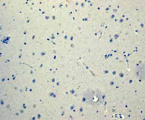 Immunohistochemistry (Formalin/PFA-fixed paraffin-embedded sections) - Anti-Glucagon antibody [EPR3070-45] (ab108426), expandable thumbnail