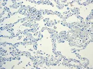Immunohistochemistry (Formalin/PFA-fixed paraffin-embedded sections) - Anti-Glucagon antibody [EPR3070-45] - BSA and Azide free (AB226035)