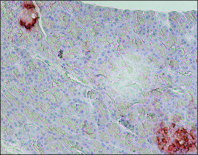 Immunohistochemistry (Formalin/PFA-fixed paraffin-embedded sections) - Anti-Glucagon antibody [K79bB10] (AB10988), expandable thumbnail