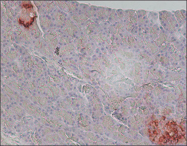 Immunohistochemistry (Formalin/PFA-fixed paraffin-embedded sections) - Anti-Glucagon antibody [K79bB10] (AB10988)