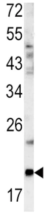 Western blot - Anti-Glucagon antibody - N-terminal (AB189279)