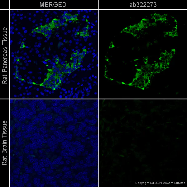Immunohistochemistry (Formalin/PFA-fixed paraffin-embedded sections) - Anti-Glucagon [EP3070] – Mouse IgG1 (Chimeric) (AB322273)