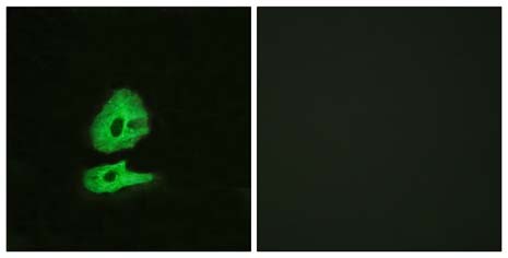 Immunocytochemistry/ Immunofluorescence - Anti-Glucagon Receptor antibody (AB75240), expandable thumbnail