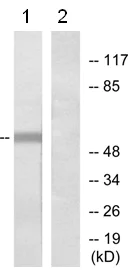 Western blot - Anti-Glucagon Receptor antibody (AB75240)
