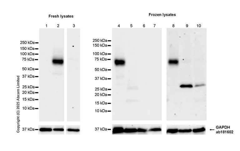 Western blot - Anti-Glucagon Receptor antibody [EPR29792-511] (AB323750)