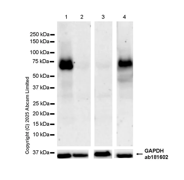 Western blot - Anti-Glucagon Receptor antibody [EPR29792-511] (AB323750)