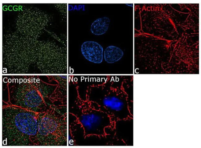 Immunocytochemistry/ Immunofluorescence - Anti-Glucagon Receptor antibody [RP23040219] (AB313488)