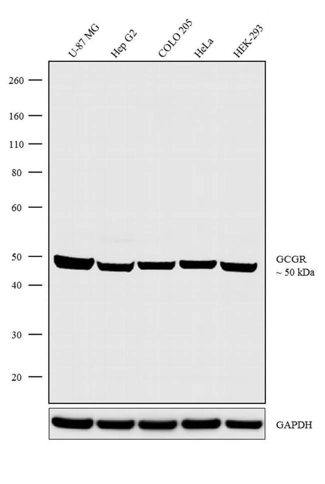 Western blot - Anti-Glucagon Receptor Antibody [RP23040219] (AB313488)